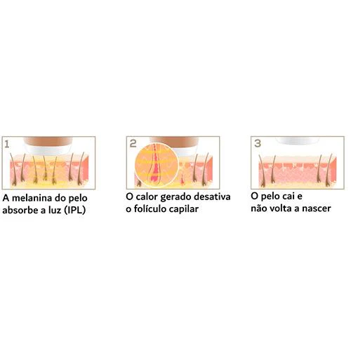 Depiladora de Luz Pulsada - IPL Beurer IPL8500 Velvet Skin Pro - Branco - Image 3