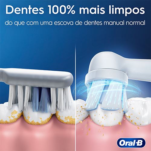 Escova de Dentes Elétrica Oral-B iO 2 | Estojo De Viagem - Rosa - Image 2